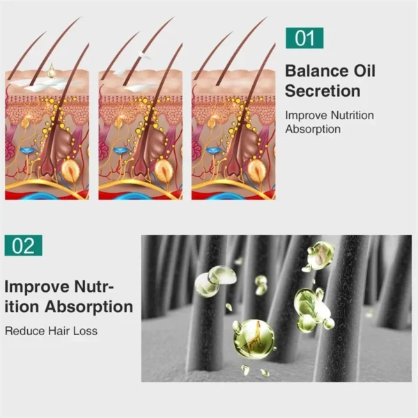 Hair Growth Essence Oil Ginger Hair Growth Oil Anti Hair Loss Prevent Baldness Treatment Fast Nourish Scalp Hair Care - Image 5